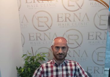 erna hair clinic-17
