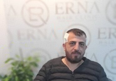 erna hair clinic-15